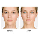 KIT 2 Adesivos de Silicone Anti Rugas Reutilizáveis SilicSmooth